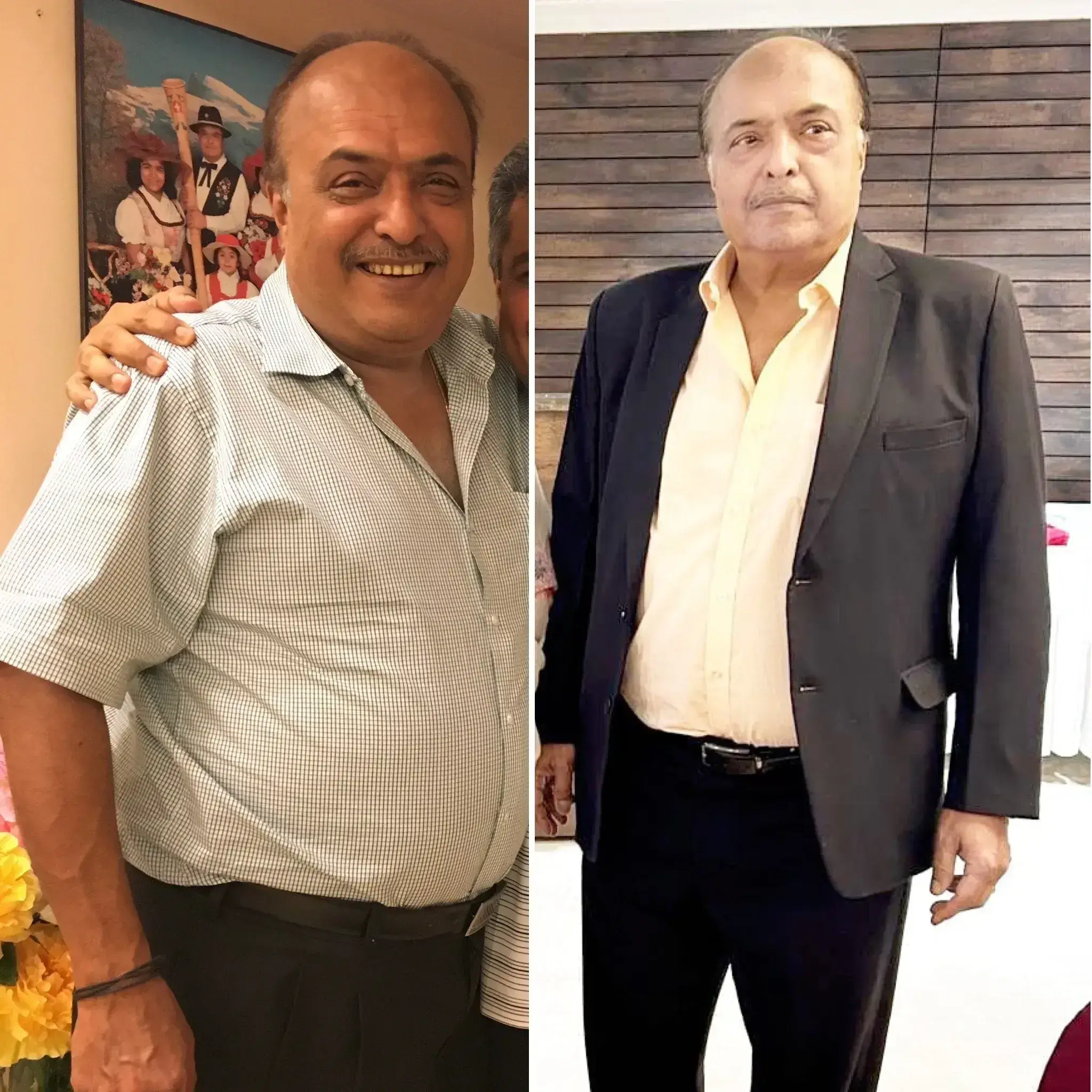 RR transformation