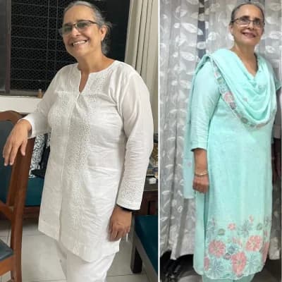 SK transformation